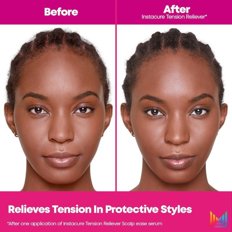 Instacure Repair Tension Reliever - Image 2