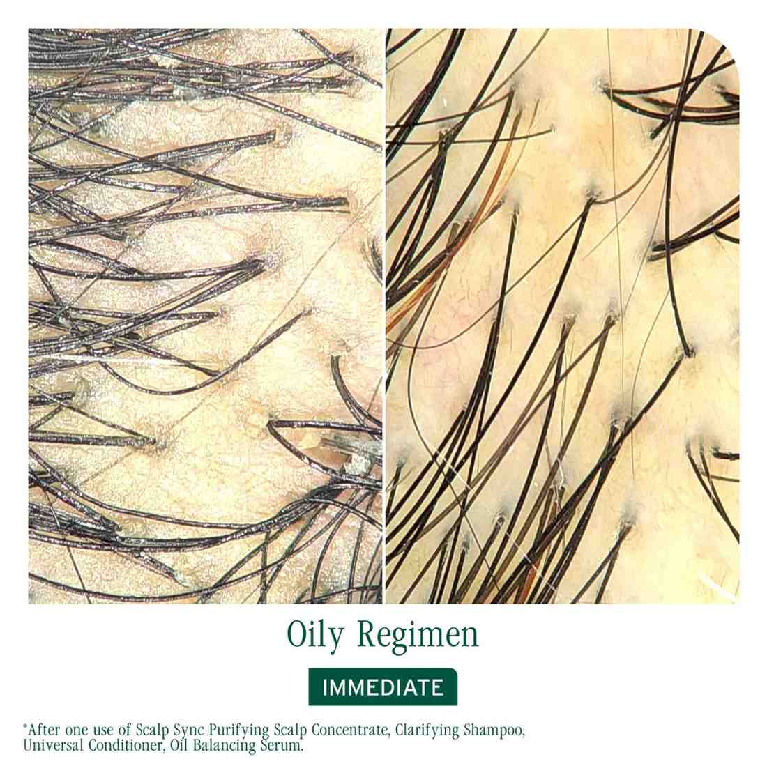 SCALP SYNC BIO SCP SYN SERUM - Image 3