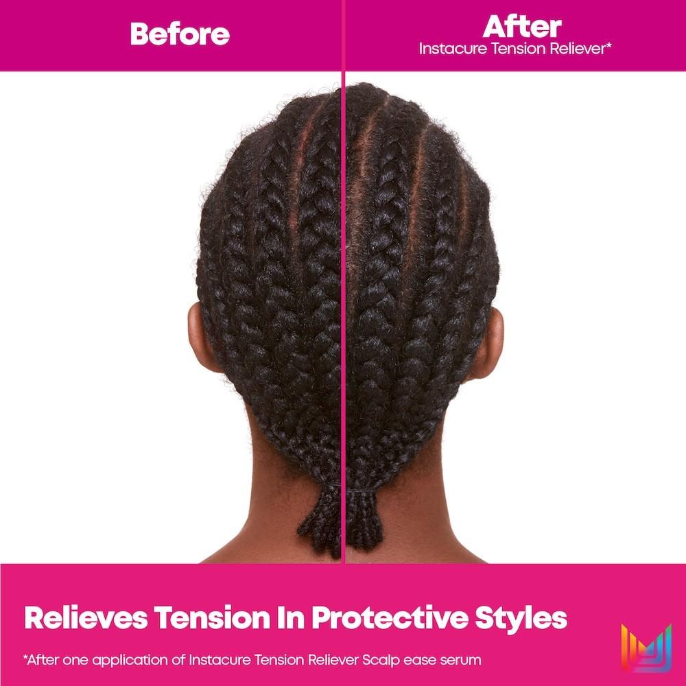 Instacure Repair Tension Reliever - Image 4