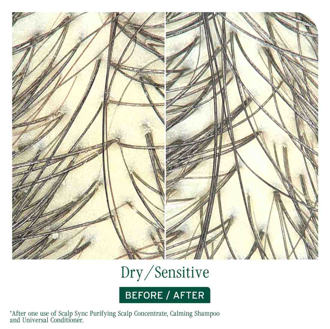 SCALP SYNC PURIFYING CONCENTRATE - Image 2