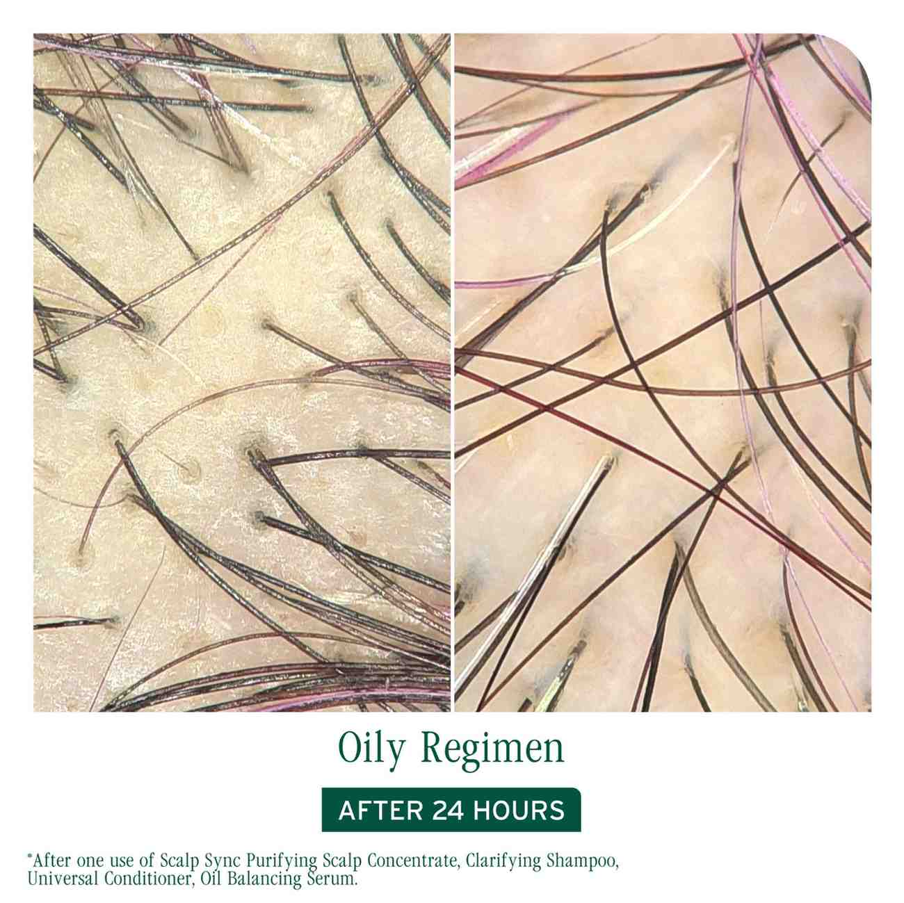 SCALP SYNC PURIFYING CONCENTRATE - Image 4