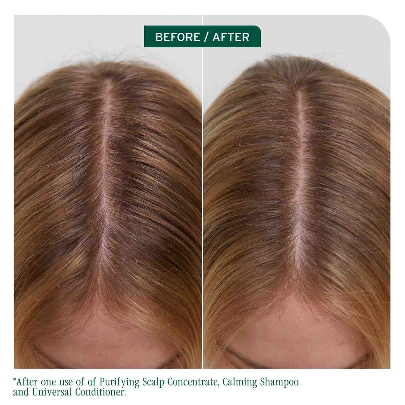 SCALP SYNC PURIFYING CONCENTRATE - Image 5