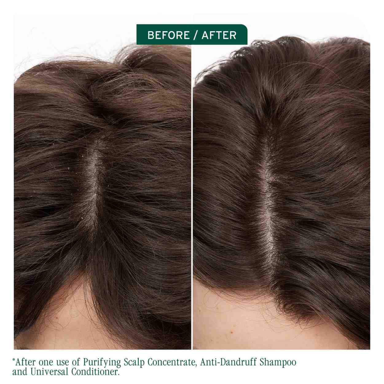 SCALP SYNC PURIFYING CONCENTRATE - Image 6
